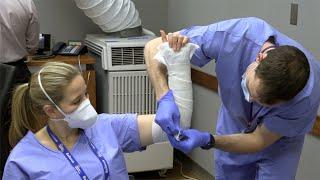 Orthopedic Splinting Basics: AO Splint, Sugar Tong Splint, Thumb Spica Splint