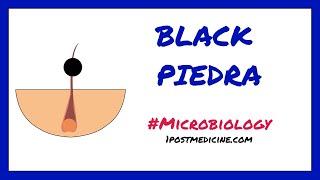 BLACK PIEDRA // Microbiology