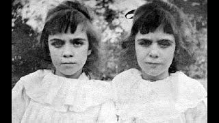 The Unsettling Case of the Pollock Twins