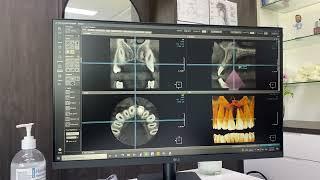 Orchard Dental KaVo (Dexis) OP3D CBCT