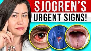 10 BAD SIGNS of Sjogren’s Syndrome - A Very Complex Autoimmune Disease