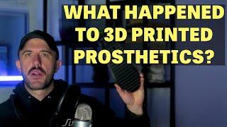 Bring Back 3d Printed Prosthetics? | 3D Printed Lamps at the Grammys | Aerospace 3D Printing News