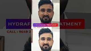 How Hydra Facial Treatment Rose to The #1 Trend on Social Media | Viral #shorts
