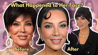 Kris Jenner’s Uncanny Facelift & the Dystopian Future of Aging