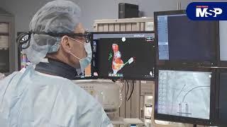 Catéter de mapeo OPTRELL en Centro Cardiovascular de Puerto Rico y del Caribe
