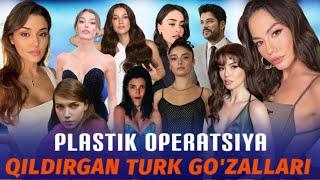 HAMMASI SOHTA GO'ZALLIK EKAN! TURK AKTRISALARI YUZINI NEGA PLASTIK OPERATSIYA QILDIRYABDI?