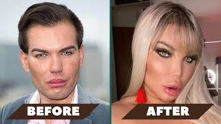 “My million-dollar plastic surgery scam!” | Opt into Beauty