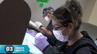 Hair Transplant Procedure 4 Phase Breakdown | Jeff Brummett