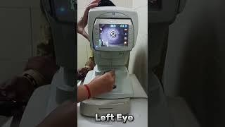Computerized Machine (AR) se Eye Testing And Keratometry (k1&k2) measure krna #eyes