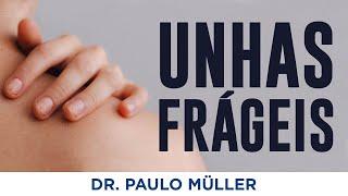 Unhas Fracas: Principais Causas - Dr. Paulo Müller Dermatologista.