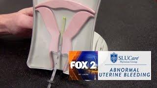 Abnormal Uterine Bleeding - SLUCare Health Watch