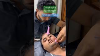 Cupping therapy for facial palsy. PHYSIO+ Ahmedabad #facialparalysis #facialpalsy #ahmedabad #gujrat