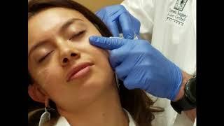 Cheekbone Augmentation | El Paso Cosmetic Surgery