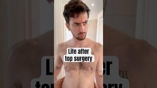 Life after trans top surgery