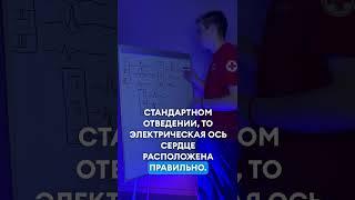 Как можно быстро определить положение ЭОС? #экг #медицина