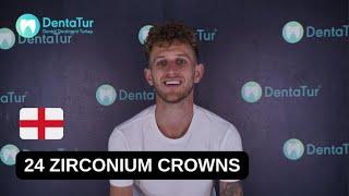 Zirconium Crowns Journey in Dentatur Turkey | UK Patient