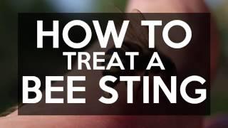 How to Treat a Bee Sting