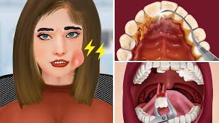 Relaxing Dental ASMR: Tartar Removal and Double Teeth Extraction Animation | JINJJA 진짜 ASMR