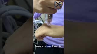HydraFacial Treatment