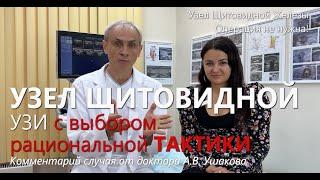 УЗИ выявило Узел щитовидной железы. Показания к операции нет // Консультирует доктор Ушаков