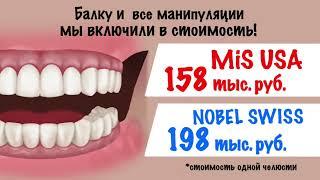 All-on-4 имплантация - что это? Как проходит протезирование, что включено в стоимость "под ключ"