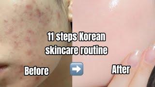 11 steps Korean Skincare Routine #skincare #korean #aesthetic #shots #youtube