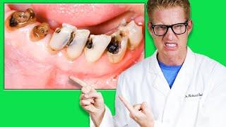 WHAT CAUSES CAVITIES & How to Prevent Tooth Decay! Dental Caries Explained by a Dentist