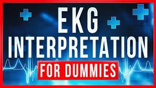 EKG Interpretation for DUMMIES