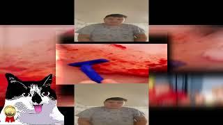 YTPMV Radmir fainted because of a crazy life hack Scan