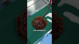 Lotus Birth Explained