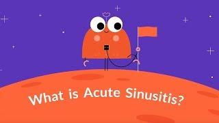 What is Acute Sinusitis? (Treatment, Symptoms, Causes)