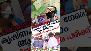 Krishnakumar G Got Seriously Poked on his Right Eye by some Opposers #shorts #viral #trending
