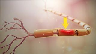 Natural ways to Improve Nerve Damage #HealthTube