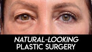 Natural Looking Plastic Surgery