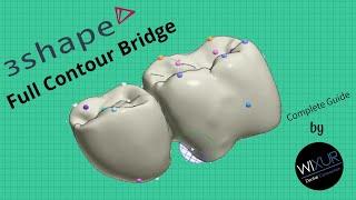 3Shape Tutorial - Full Contour Bridge