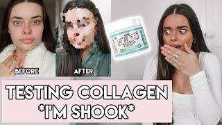 COLLAGEN SUPPLEMENT FOR 30 DAYS | Does it work? Before & Afters | I can't believe the results!