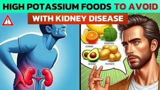 High potassium foods to avoid with kidney disease