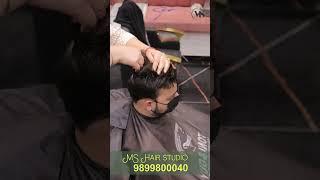 Taping Hair Patch System in Delhi | MS Hair Studio #hairpatch