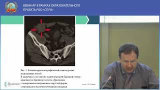 Стандартное мультимодальное УЗИ в современной диагностике опухолей мягких тканей