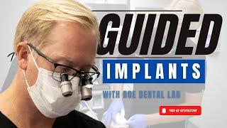 Guided Dental Implants Using Roe Dental Labs