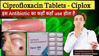 Ciprofloxacin tablet | Ciplox tablet | Zoxan tablet, uses , side effects in hindi | Medicine info