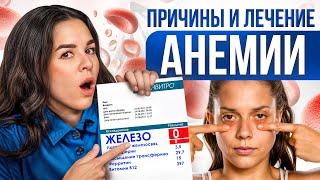 Как понять, что у тебя ЖЕЛЕЗОДЕФИЦИТ? ТОП 10 важных продуктов в рационе при АНЕМИИ