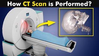 What is CT Scan? | How CT Scan Is Performed? (Urdu/Hindi)