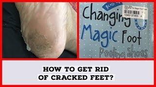 Dry Heels?| Tony Moly Changing Magic Foot Peeling Shoes -For Soft Feet