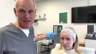 Where to Inject Botox for Forehead Lines / Frontalis | Cosmetic Courses, Mr Adrian Richards