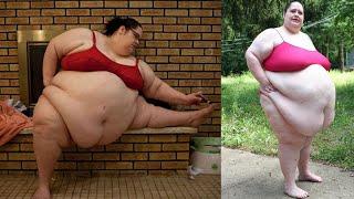 Want To Be The Fattest Woman In The World | Donna Simpson | Things around