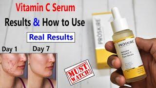 7 Days Results - Proskire Vitamin C Serum - Skin Brightening ? Serum For Glowing Skin & Dark Spots