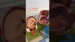 Placenta previa #mbbs #medical #anatomy #pregnancy