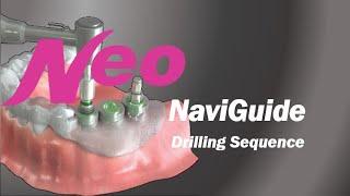 NaviGuide: Drilling Sequence