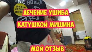 Лечение ушиба катушкой Мишина  Мой отзыв